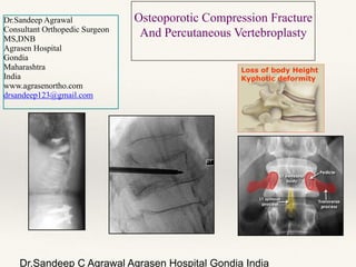 Dr.Sandeep C Agrawal Agrasen Hospital Gondia India!
Osteoporotic Compression Fracture
And Percutaneous Vertebroplasty 
Loss of body Height
Kyphotic deformity
Dr.Sandeep Agrawal
Consultant Orthopedic Surgeon
MS,DNB
Agrasen Hospital
Gondia
Maharashtra
India
www.agrasenortho.com
drsandeep123@gmail.com
 