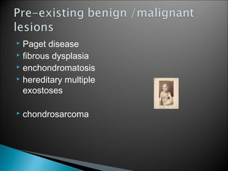  Paget disease
 fibrous dysplasia
 enchondromatosis
 hereditary multiple
exostoses
 chondrosarcoma
 