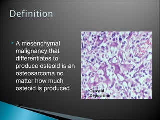  A mesenchymal
malignancy that
differentiates to
produce osteoid is an
osteosarcoma no
matter how much
osteoid is produced Osteoid
Deposition
 