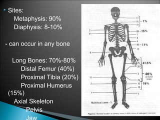  Sites:
Metaphysis: 90%
Diaphysis: 8-10%
- can occur in any bone
Long Bones: 70%-80%
Distal Femur (40%)
Proximal Tibia (20%)
Proximal Humerus
(15%)
Axial Skeleton
Pelvis
 