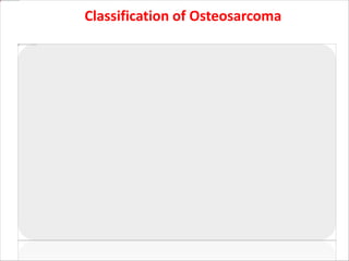 Classification of Osteosarcoma
 