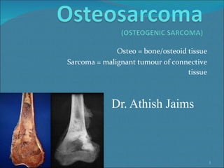 Osteo = bone/osteoid tissue
Sarcoma = malignant tumour of connective
tissue
02/04/12
Dr. Athish Jaims
1
 