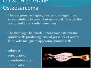 Classic High Grade Osteosarcoma These aggressive, high-grade tumors begin in an intramedullary location, but may break through the cortex and form a soft-tissue mass. The histologic hallmark -  malignant osteoblastic spindle cells producing osteoid,presence of woven bone with malignant appearing stromal cells subtypes  -  osteoblastic,  chondroblastic and fibroblastic 