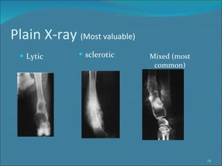 Plain X-ray  (Most valuable) sclerotic Lytic Mixed (most common) 