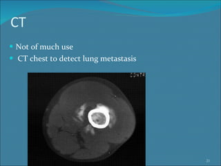 CT Not of much use CT chest to detect lung metastasis 
