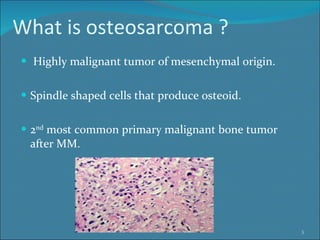 What is osteosarcoma ? Highly malignant tumor of mesenchymal origin. Spindle shaped cells that produce osteoid. 2 nd  most common primary malignant bone tumor after MM. 