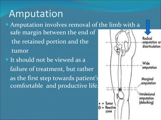 Amputation Amputation involves removal of the limb with a safe margin between the end of  the retained portion and the  tumor It should not be viewed as a  failure of treatment, but rather as the first step towards patient’s return to a more comfortable  and productive life. 
