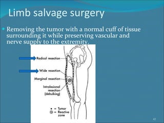 Limb salvage surgery Removing the tumor with a normal cuff of tissue surrounding it while preserving vascular and nerve supply to the extremity.  