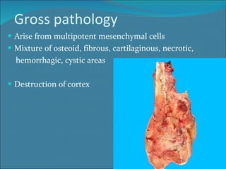 Gross pathology Arise from multipotent mesenchymal cells Mixture of osteoid, fibrous, cartilaginous, necrotic,  hemorrhagic, cystic areas Destruction of cortex 