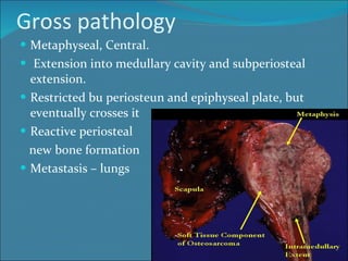 Gross pathology Metaphyseal, Central. Extension into medullary cavity and subperiosteal extension.  Restricted bu periosteun and epiphyseal plate, but eventually crosses it Reactive periosteal  new bone formation Metastasis – lungs  