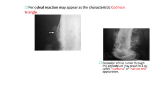 Periosteal reaction may appear as the characteristic Codman
triangle.
Extension of the tumor through
the periosteum may result in a so-
called “sunburst” or “hair on end”
appearance.
 