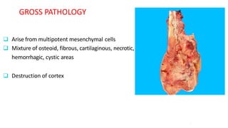  Arise from multipotent mesenchymal cells
 Mixture of osteoid, fibrous, cartilaginous, necrotic,
hemorrhagic, cystic areas
 Destruction of cortex
7
GROSS PATHOLOGY
 