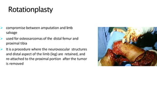  compromise between amputation and limb
salvage
 used for osteosarcomas of the distal femur and
proximal tibia
 It is a procedure where the neurovascular structures
and distal aspect of the limb (leg) are retained, and
re-attached to the proximal portion after the tumor
is removed
Rotationplasty
 