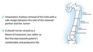  Amputation involves removal of the limb with a
safe margin between the end of the retained
portion and the tumor
 It should not be viewed as a
failure of treatment, but rather as
the first step towards patient’s
comfortable and productive life.
 