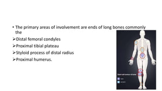 • The primary areas of involvement are ends of long bones commonly
the
Distal femoral condyles
Proximal tibial plateau
Styloid process of distal radius
Proximal humerus.
 