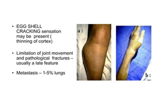 • EGG SHELL
CRACKING sensation
may be present (
thinning of cortex)
• Limitation of joint movement
and pathological fractures –
usually a late feature
• Metastasis – 1-5% lungs
 