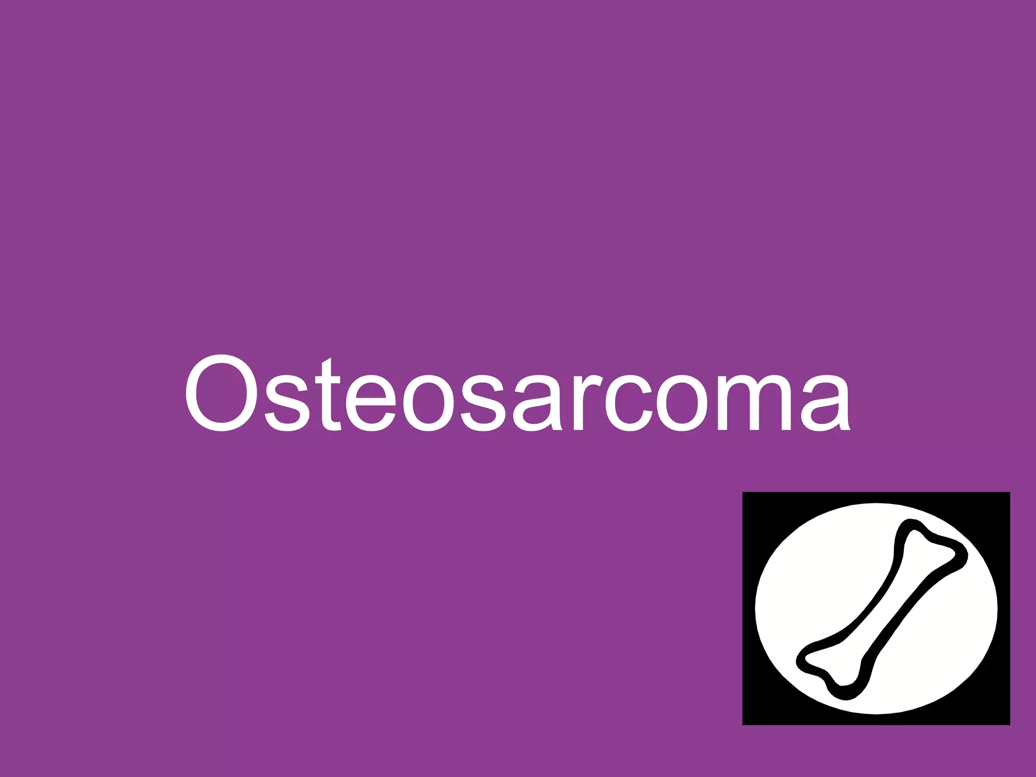 osteosarcoma-asia-g-ppt
