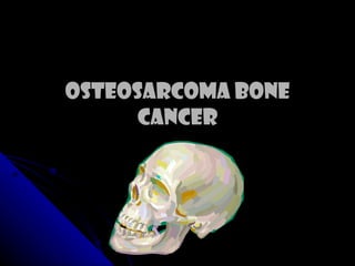 Osteosarcoma Bone Cancer 