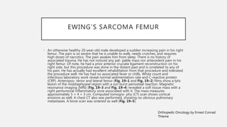 EWING’S SARCOMA FEMUR
• An otherwise healthy 20-year-old male developed a sudden increasing pain in his right
femur. The pain is so severe that he is unable to walk, needs crutches, and requires
high doses of narcotics. The pain awakes him from sleep. There is no history of
associated trauma. He has not noticed any pal- pable mass nor antecedent pain in his
right femur. Of note, he had a prior anterior cruciate ligament reconstruction on his
right side, but this procedure was done in the distant past and is unrelated to any of
his pain. He has actually had excellent rehabilitation from that procedure and tolerated
the procedure well. He has had no associated fever or chills. White count and
infectious laboratory work reveal normal sedimentation rate and C-reactive protein
(CRP). Anteropos- terior and lateral femur (Fig. 19–1 and Fig. 19–2) films show a lytic
lesion of the middiaphyseal region with a sun burst periosteal reaction. Magnetic
resonance imaging (MRI) (Fig. 19–3 and Fig. 19–4) revealed a soft tissue mass with a
right peritumoral inflammatory zone associated with it. The mass measures
approximately 5 × 4 × 3 cm. Computed tomogra- phy (CT) scan shows cortical
erosions as well. A chest CT also was performed, showing no obvious pulmonary
metastases. A bone scan was ordered as well (Fig. 19–5).
Orthopedic Oncology by Ernest Conrad
Thieme
 