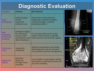 Osteosarcoma:-DIAGNOSIS AND TREATMENTpptx | PPTX