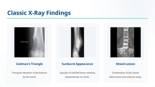 Bone tumour special Osteosarcoma Overview.pptx