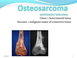 Osteo = bone/osteoid tissue
Sarcoma = malignant tumor of connective tissue
04/28/14 1
 
