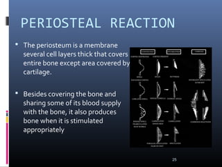PERIOSTEAL REACTION
 The periosteum is a membrane
several cell layers thick that covers
entire bone except area covered by
cartilage.
 Besides covering the bone and
sharing some of its blood supply
with the bone, it also produces
bone when it is stimulated
appropriately
25
 