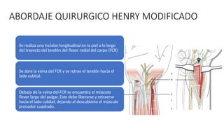 Fcr Tendon Incision Osteosíntesis en Miembro Superior: Técnicas y Consideraciones ...