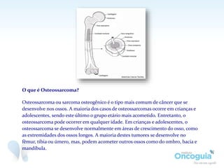 O que é Osteossarcoma?
Osteossarcoma ou sarcoma osteogênico é o tipo mais comum de câncer que se
desenvolve nos ossos. A maioria dos casos de osteossarcomas ocorre em crianças e
adolescentes, sendo este último o grupo etário mais acometido. Entretanto, o
osteossarcoma pode ocorrer em qualquer idade. Em crianças e adolescentes, o
osteossarcoma se desenvolve normalmente em áreas de crescimento do osso, como
as extremidades dos ossos longos. A maioria destes tumores se desenvolve no
fêmur, tíbia ou úmero, mas, podem acometer outros ossos como do ombro, bacia e
mandíbula.
 