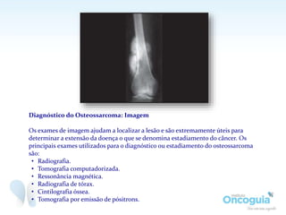 Diagnóstico do Osteossarcoma: Imagem
Os exames de imagem ajudam a localizar a lesão e são extremamente úteis para
determinar a extensão da doença o que se denomina estadiamento do câncer. Os
principais exames utilizados para o diagnóstico ou estadiamento do osteossarcoma
são:
• Radiografia.
• Tomografia computadorizada.
• Ressonância magnética.
• Radiografia de tórax.
• Cintilografia óssea.
• Tomografia por emissão de pósitrons.
 