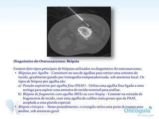 Diagnóstico do Osteossarcoma: Biópsia
Existem dois tipos principais de biópsias utilizadas no diagnóstico do osteossarcoma:
• Biópsias por Agulha - Consistem no uso de agulhas para retirar uma amostra de
tecido, geralmente guiado por tomografia computadorizada, sob anestesia local. Os
tipos de biópsia por agulha são:
a) Punção aspirativa por agulha fina (PAAF) - Utiliza uma agulha fina ligada a uma
seringa para aspirar uma amostra do tecido tumoral para análise.
b) Biópsia de fragmento com agulha (BFA) ou core biopsy - Consiste na retirada de
fragmentos de tecido, com uma agulha de calibre mais grosso que da PAAF,
acoplada a uma pistola especial.
• Biópsia cirúrgica – Neste procedimento, o cirurgião retira uma parte do tumor para
análise, sob anestesia geral.
 