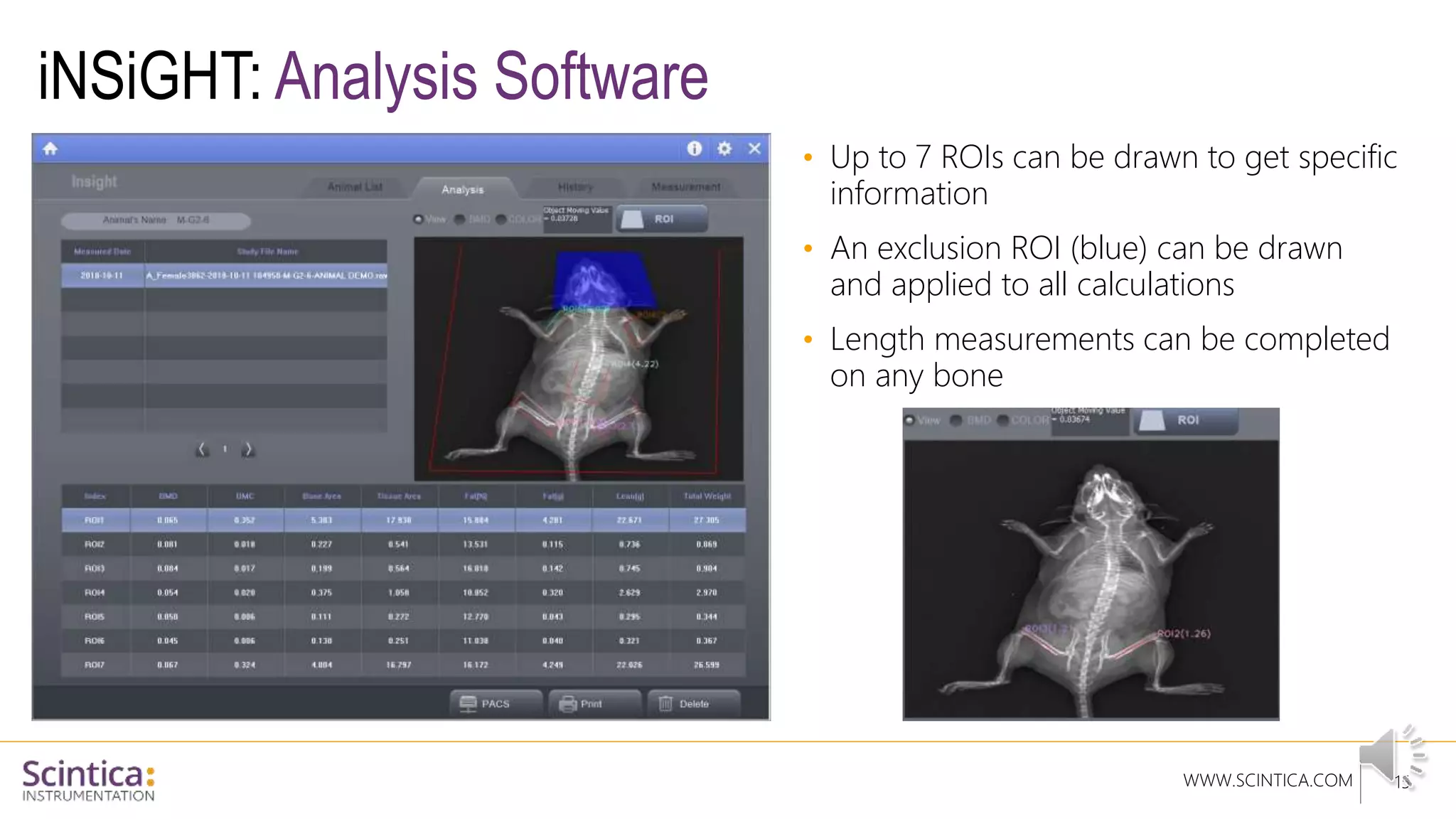 WWW.SCINTICA.COM
iNSiGHT: Analysis Software
15
• Up to 7 ROIs can be drawn to get specific
information
• An exclusion ROI (blue) can be drawn
and applied to all calculations
• Length measurements can be completed
on any bone
 