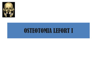 OSTEOTOMIA LEFORT I
 
