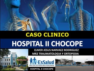 HOSPITAL II CHOCOPE
CASO CLINICO
ELMER JESUS NARVAEZ RODRIGUEZ
MR2 TRAUMATOLOGIA Y ORTOPEDIA
 