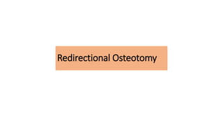 Osteotomies around hip in DDH | PPTX