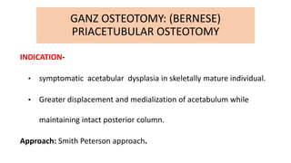 Osteotomies around hip in DDH | PPTX