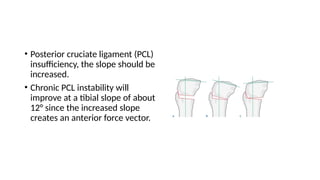 Increased Slope Osteotomies around knee.pptx............ | PPTX