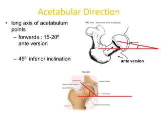 Osteotomies around the hip | PPTX