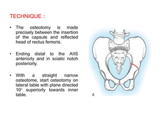 Osteotomies around the hip | PPTX