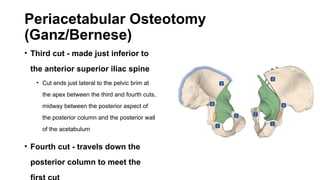 OSTEOTOMIES AROUND THE HIP (Acetabular and Proximal Femur).pptx