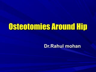 Osteotomies Around HipOsteotomies Around Hip
Dr.Rahul mohanDr.Rahul mohan
 