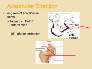 Osteotomyaroundhip | PPTX