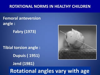 Osteotomy around the knee in children.when and why? | PPTX