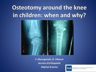 Osteotomy around the knee
in children: when and why?
F. Moungondo ,R. Elbaum
Service d’orthopédie
Hôpital Erasme
 
