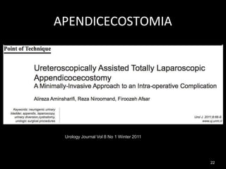 APENDICECOSTOMIA
Urology Journal Vol 8 No 1 Winter 2011
22
 