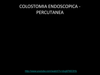 COLOSTOMIA ENDOSCOPICA -
PERCUTANEA
http://www.youtube.com/watch?v=dvg87t6C91k
 