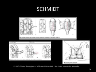 SCHMIDT
© 2002, Editions Scientifiques et Médicales Elsevier SAS, París. Todos los derechos reservados.
34
 