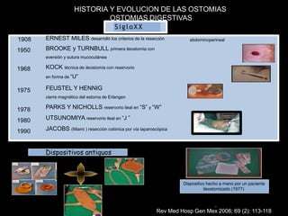 SigloXX
Dispositivos antiguos
Dispositivo hecho a mano por un paciente
ileostomizado (1977)
)
HISTORIA Y EVOLUCION DE LAS OSTOMIAS
OSTOMIAS DIGESTIVAS
abdominoperineal
1968
1908
1950
1975
1978
1980
1990
ERNEST MILES desarrolló los criterios de la resección
BROOKE y TURNBULL primera ileostomía con
eversión y sutura mucocutánea
KOCK técnica de ileostomía con reservorio
en forma de “U”
FEUSTEL Y HENNIG
cierre magnético del estoma de Erlangen
PARKS Y NICHOLLS reservorio ileal en “S” y “W”
UTSUNOMIYA reservorio ileal en “J ”
JACOBS (Miami ) resección colónica por vía laparoscópica
Rev Med Hosp Gen Mex 2006; 69 (2): 113-118
 