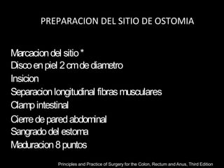 PREPARACION DEL SITIO DE OSTOMIA
Marcaciondel sitio*
Discoenpiel 2cmdediametro
Insicion
Separacionlongitudinal fibrasmusculares
Clampintestinal
Cierredeparedabdominal
Sangradodel estoma
Maduracion8puntos
Principles and Practice of Surgery for the Colon, Rectum and Anus, Third Edition
 