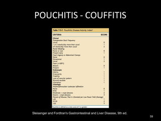 Sleisenger and Fordtran's Gastrointestinal and Liver Disease, 9th ed.
POUCHITIS - COUFFITIS
59
 